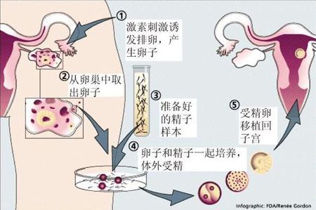 青碧生殖医学中心